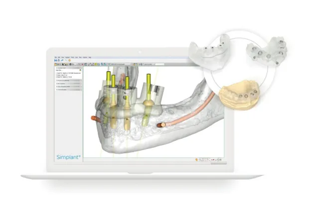 シンプラント（インプラント手術シミュレーションソフト）