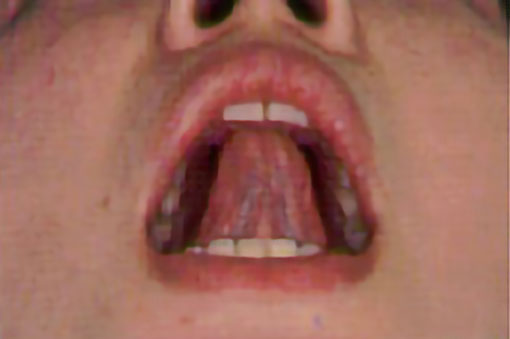 図2 前歯の後ろに舌の先をとがらせてつける